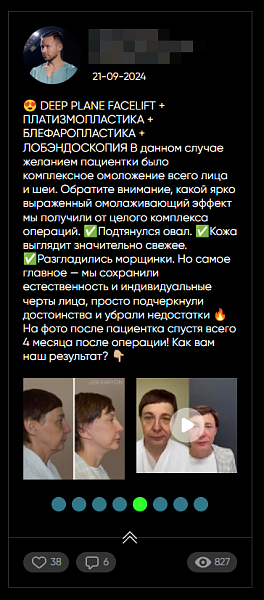 Стена ВК | VK | Вконтакте на своем сайте (посты) — скриншот 2